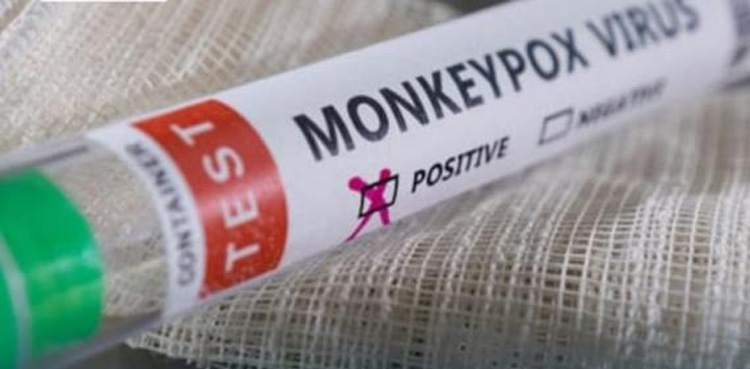 KP reports three confirm cases of monkeypox virus