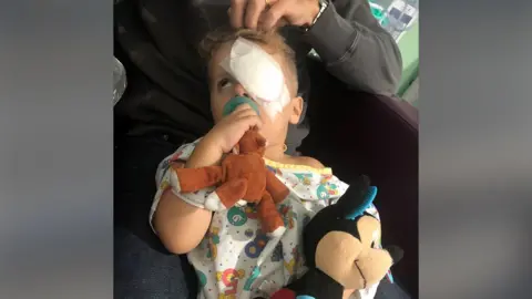 Moorfields Hospital Jace has a white bandage covering one eye and he sits on an adult's knee, cuddling soft toys and wearing a children's colourful hospital gown