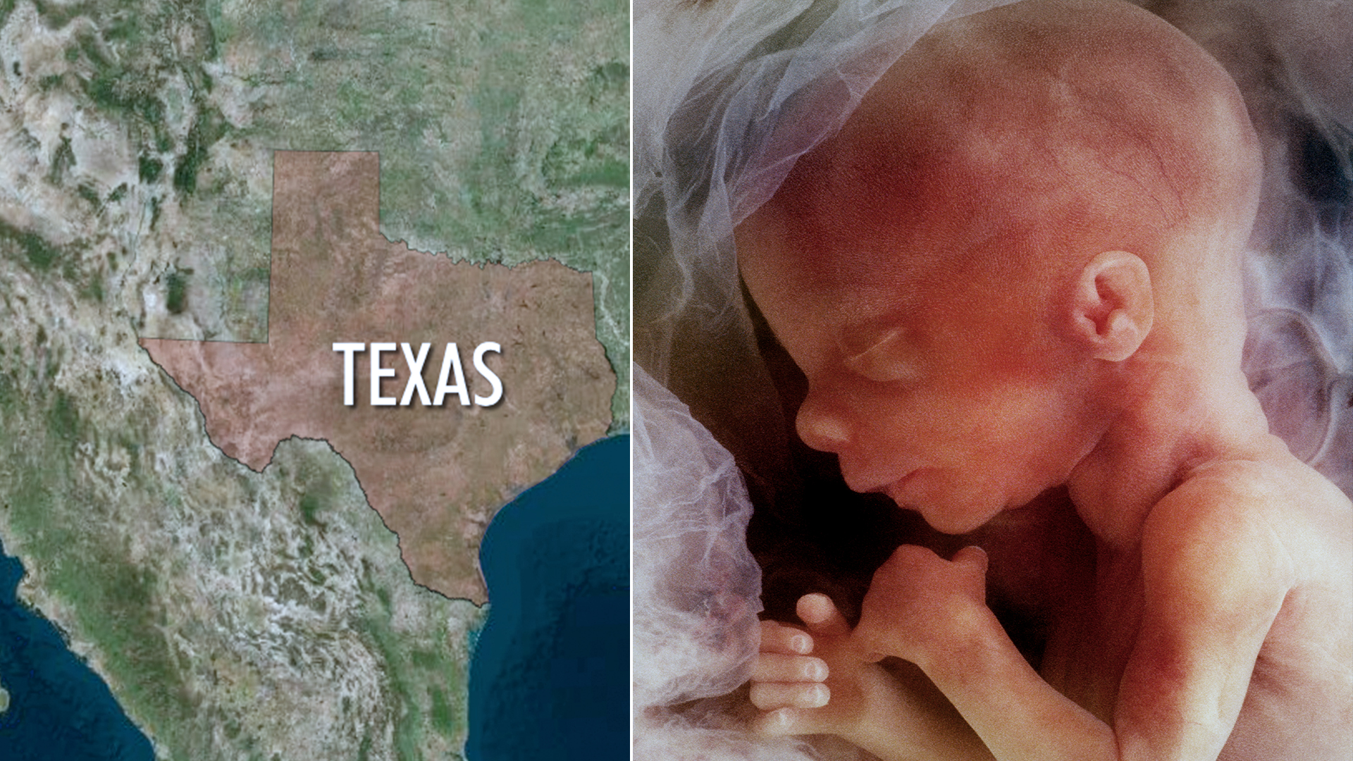 Texas Midwife Arrested, Accused by Attorney General of Committing Illegal Abortions